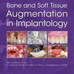 Bone and Soft Tissue Augmentation in Implantology 1st Edition PDF Free Download